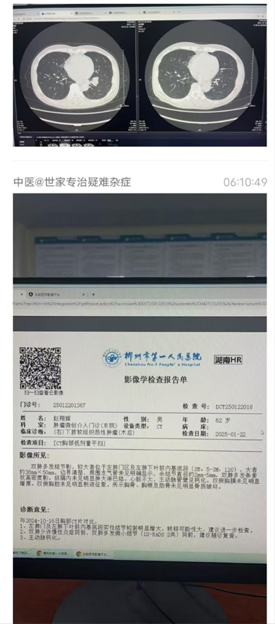 八一建军节98周年专题报道 清代御医第四代传人——黎化雨