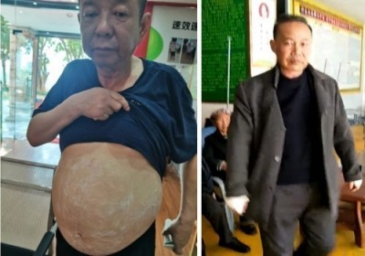 2026中国医学功勋人物报道 广西百色市杨忠雅治疗各种癌症有成就