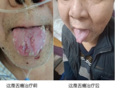 2026中国医学功勋人物报道 广西百色市杨忠雅治疗各种癌症有成就