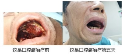 2026中国医学功勋人物报道 广西百色市杨忠雅治疗各种癌症有成就