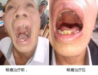 2026中国医学功勋人物报道 广西百色市杨忠雅治疗各种癌症有成就