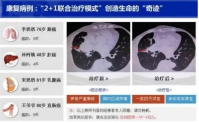 冉明医师创新国医精粹 铺就患者“健康之路