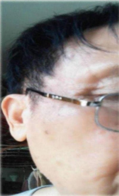 量子氢氧健康第一人长寿哥（廖永贵) 让科学量氢氧品牌走向世界!